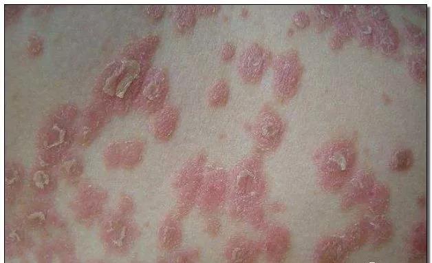 1623199878921401.jpg 3.jpg